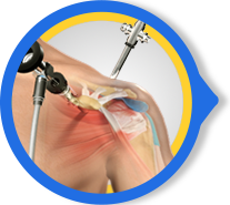 Arthroscopic Surgery